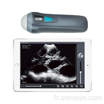 Scanner à ultrasons vétérinaire sans fil